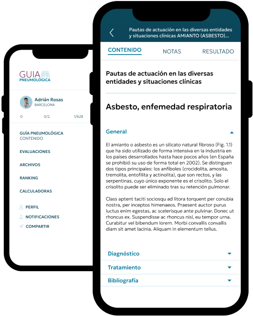 Vista de la app Guía Pneumológica en móvil